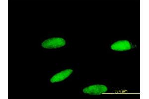 anti-Zinc Finger Protein 587 (ZNF587) (AA 1-122) antibody