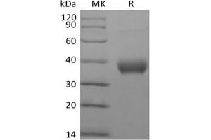 Western Blotting (WB) image for Butyrophilin, Subfamily 1, Member A1 (BTN1A1) protein (Biotin,His-Avi Tag) (ABIN7319877)