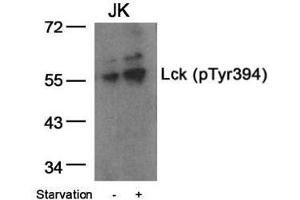 Image no. 1 for anti-Lymphocyte-Specific Protein tyrosine Kinase (LCK) (pTyr394) antibody (ABIN196861) (LCK anticorps  (pTyr394))