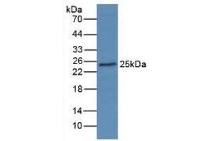 Figure. (AGR2 anticorps  (AA 21-175))