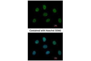 ICC/IF Image Immunofluorescence analysis of paraformaldehyde-fixed MCF-7, using MAD1, antibody at 1:500 dilution.