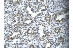 Rabbit Anti-SUPT5H Antibody Catalog Number: ARP33386  Paraffin Embedded Tissue: Human alveolar cell  Cellular Data: Epithelial cells of renal tubule Antibody Concentration:  4.