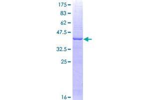 Image no. 1 for Jumping Translocation Breakpoint (JTB) (AA 1-146) protein (GST tag) (ABIN1308325)