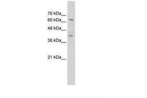 Image no. 1 for anti-Zinc Finger Protein 415 (ZNF415) (C-Term) antibody (ABIN6736301) (ZNF415 anticorps  (C-Term))