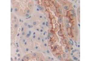 IHC-P analysis of Human Tissue, with DAB staining. (DOCK1 anticorps  (AA 1200-1435))