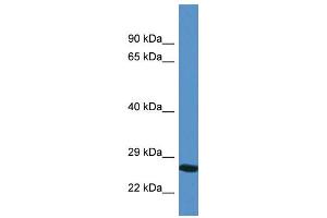 WB Suggested Anti-YIPF4 AntibodyTitration: 1. (YIPF4 anticorps  (N-Term))