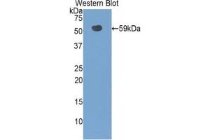 Detection of Recombinant SLC3A2, Rat using Polyclonal Antibody to Solute Carrier Family 3, Member 2 (SLC3A2)
