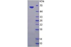 Image no. 1 for Endonuclease G (ENDOG) (AA 1-294) (Active) protein (His tag,GST tag) (ABIN6239837)