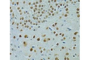 Immunohistochemistry of paraffin-embedded Mouse brain using MUS81 Polyclonal Antibody at dilution of 1:100 (40x lens). (MUS81 anticorps)