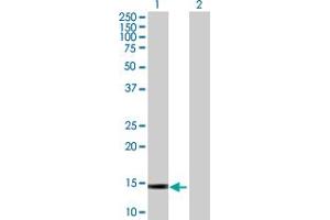 Lane 1: GALNT1 transfected lysate ( 11. (GALNT1 293T Cell Transient Overexpression Lysate(Denatured))