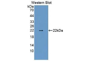 Detection of Recombinant TAZ, Mouse using Polyclonal Antibody to Tafazzin (TAZ)
