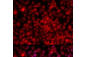Immunofluorescence analysis of U2OS cells using ILF2 Polyclonal Antibody (ILF2 anticorps)