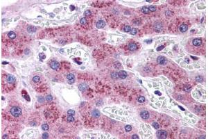 Human Liver: Formalin-Fixed, Paraffin-Embedded (FFPE) (Transmembrane Protein 18 (TMM18) (C-Term) anticorps)