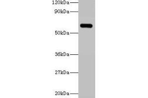 Western blot All lanes: YARS antibody at 2 μg/mL + 293T whole cell lysate Secondary Goat polyclonal to rabbit IgG at 1/15000 dilution Predicted band size: 60 kDa Observed band size: 60 kDa (YARS anticorps  (AA 2-528))