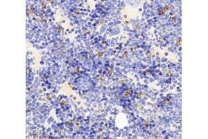 Immunohistochemistry analysis of paraffin-embedded mouse bone using,FCN1 (ABIN7073952) at dilution of 1: 3000 (FCN1 anticorps)