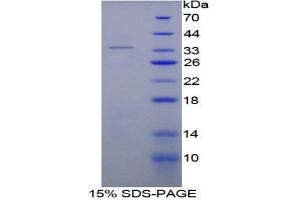 SDS-PAGE analysis of Rat Thrombin Protein. (SERPINC1 Protéine)