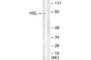 Immunohistochemistry analysis of paraffin-embedded human breast carcinoma tissue using HSL (Ab-554) antibody. (LIPE anticorps  (Ser554))
