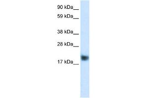 WB Suggested Anti-CSRP3 Antibody Titration:  0. (CSRP3 anticorps  (C-Term))