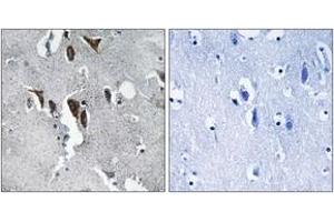 Immunohistochemistry analysis of paraffin-embedded human brain tissue, using ELOVL5 Antibody. (ELOVL5 anticorps  (AA 250-299))