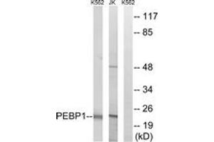 Western blot analysis of extracts from Jurkat/K562 cells, using PEBP1 Antibody. (PEBP1 anticorps  (AA 105-154))