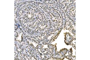 IHC analysis of SSB using anti-SSB antibody (ABIN7602125). (SSB anticorps  (AA 6-283))