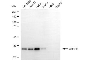 Western blotting analysis using GRHPR antibody (ABIN7798786). (GRHPR anticorps)