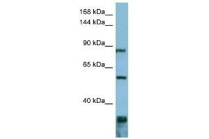 EPS8 antibody used at 1 ug/ml to detect target protein. (EPS8 anticorps  (Middle Region))