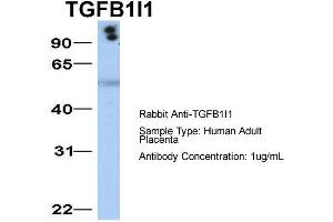 Host:  Rabbit  Target Name:  TGFB1I1  Sample Type:  Human Adult Placenta  Antibody Dilution:  1.