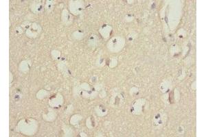 Immunohistochemistry of paraffin-embedded human brain tissue using ABIN7163172 at dilution of 1:100