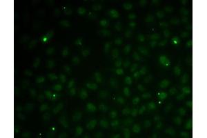 Immunofluorescence analysis of MCF7 cells using RC antibody (ABIN6132580, ABIN6146644, ABIN6146647 and ABIN6216132).