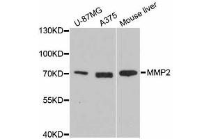 Western blot analysis of extracts of various cell lines, using MMP2 antibody. (MMP2 anticorps  (AA 40-280))