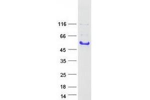 Validation with Western Blot