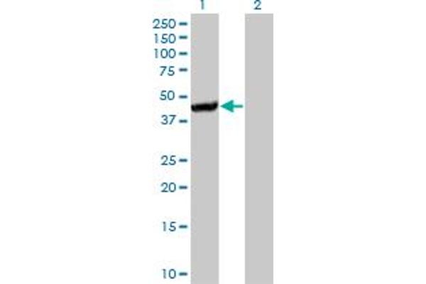CTH anticorps  (AA 1-405)