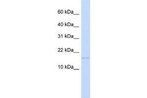 WB Suggested Anti-C3orf18 Antibody Titration:  0. (C3orf18 anticorps  (N-Term))