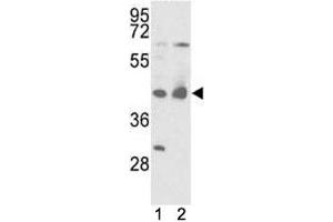 Western blot analysis of IDH antibody and mouse liver tissue and 293 lysate. (IDH1 anticorps  (AA 63-90))