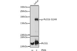 Western blot analysis of extracts of Jurkat cells, using Phospho-PLC gamma 1 (PLCG1)-S1248 antibody (ABIN7269347) at dilution or PLC gamma 1 (PLCG1) antibody . (Phospholipase C gamma 1 anticorps  (pSer1248))
