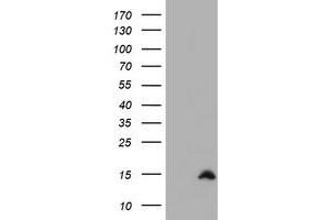 Image no. 1 for anti-Cystatin SA (CST2) antibody (ABIN1497760) (CST2 anticorps)