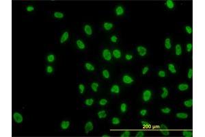 Immunofluorescence of monoclonal antibody to ARID1B on HeLa cell. (ARID1B anticorps  (AA 1364-1460))