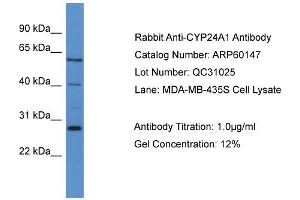 WB Suggested Anti-CYP24A1  Antibody Titration: 0. (CYP24A1 anticorps  (C-Term))