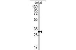 Western blot analysis of CDK2 polyclonal antibody  in Jurkat cell line lysates (35 ug/lane). (CDK2 anticorps  (C-Term))