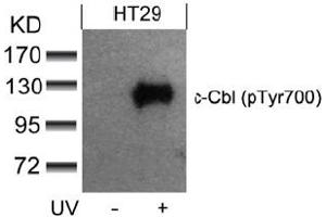 Image no. 3 for anti-Cas-Br-M (Murine) Ecotropic Retroviral Transforming Sequence (CBL) (pTyr700) antibody (ABIN319294) (CBL anticorps  (pTyr700))