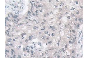 anti-VAMP (Vesicle-Associated Membrane Protein)-Associated Protein B and C (VAPB) (AA 1-132) antibody