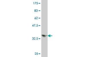 Western Blot detection against Immunogen (37 KDa) .
