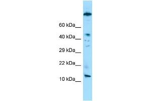 WB Suggested Anti-VCY Antibody Titration: 1. (Variable Charge, Y-Linked (VCY) (N-Term) anticorps)