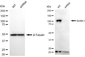 anti-Sortilin 1 (SORT1) antibody