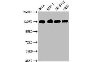 Western Blot Positive WB detected in: Hela whole cell lysate, MCF-7 whole cell lysate, SH-SY5Y whole cell lysate, U251 whole cell lysate All lanes: Integrin beta-1/CD29 antibody at 1. (Recombinant ITGB1 anticorps)