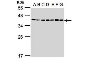 WB Image Sample(30μg whole cell lysate) A: 293T B: A431 , C: H1299 D: HeLa S3 , E: Hep G2 , F: MOLT4 , G: Raji , 12% SDS PAGE antibody diluted at 1:1000 (U2AF1 anticorps)