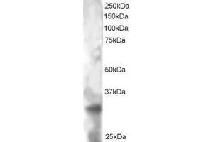 ABIN184746 staining (2µg/ml) of HeLa lysate (RIPA buffer, 30µg total protein per lane). (TSPAN32 anticorps  (C-Term))