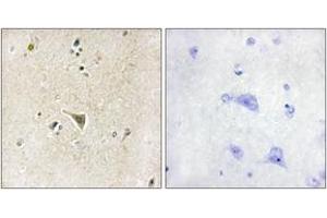 Immunohistochemistry analysis of paraffin-embedded human brain tissue, using LRRK1 Antibody. (LRRK1 anticorps  (AA 361-410))