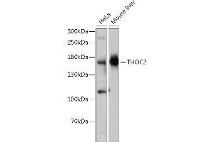 Western blot analysis of extracts of various cell lines, using THOC2 antibody (ABIN7270812) at 1:1000 dilution. (THO Complex 2 anticorps)